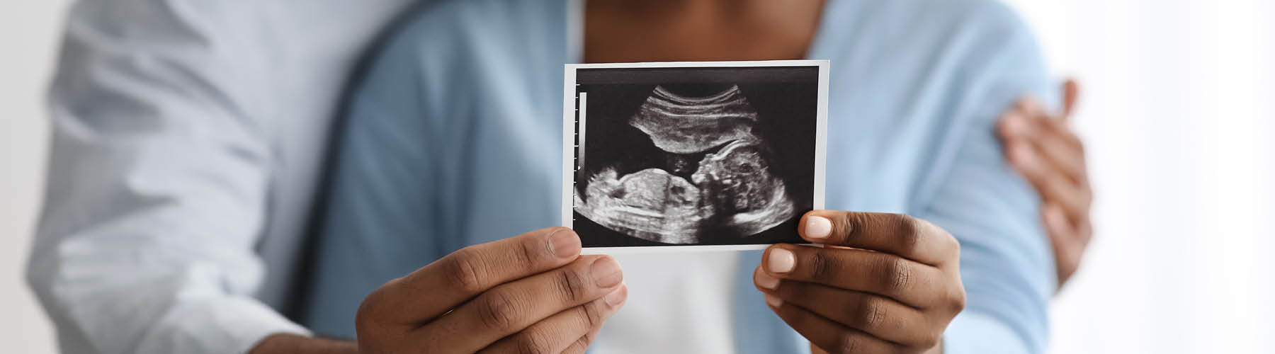 A couple holds a black and white picutre of their child's sonogram image. A couple holds a black and white picutre of their child's sonogram image.